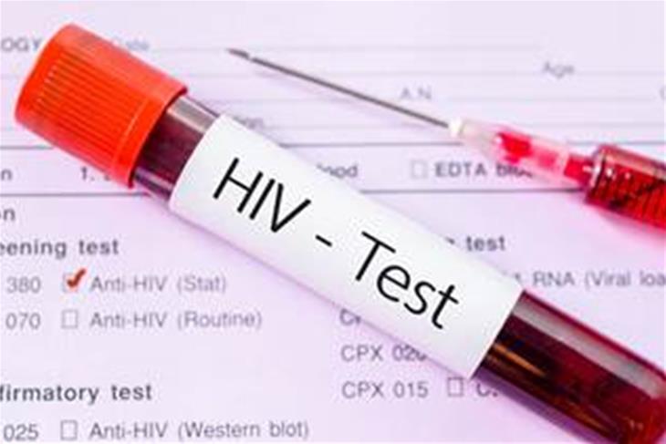 Ministry of Health plans to implement the compulsory HIV/AIDS testing strategy.