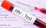 Ministry of Health plans to implement the compulsory HIV/AIDS testing strategy.
